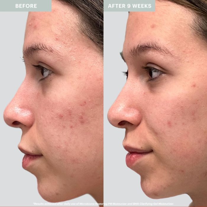 Glo Skincare Microbiome Restoring PM Moisturizer - Image 3
