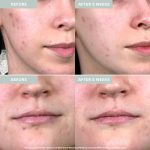 Glo Skincare Microbiome Restoring PM Moisturizer - Image 2