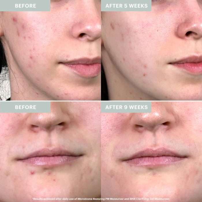 Glo Skincare Microbiome Restoring PM Moisturizer - Image 2