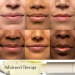 Fresh Sugar Advanced Therapy Lip Treatment Balm - Image 6